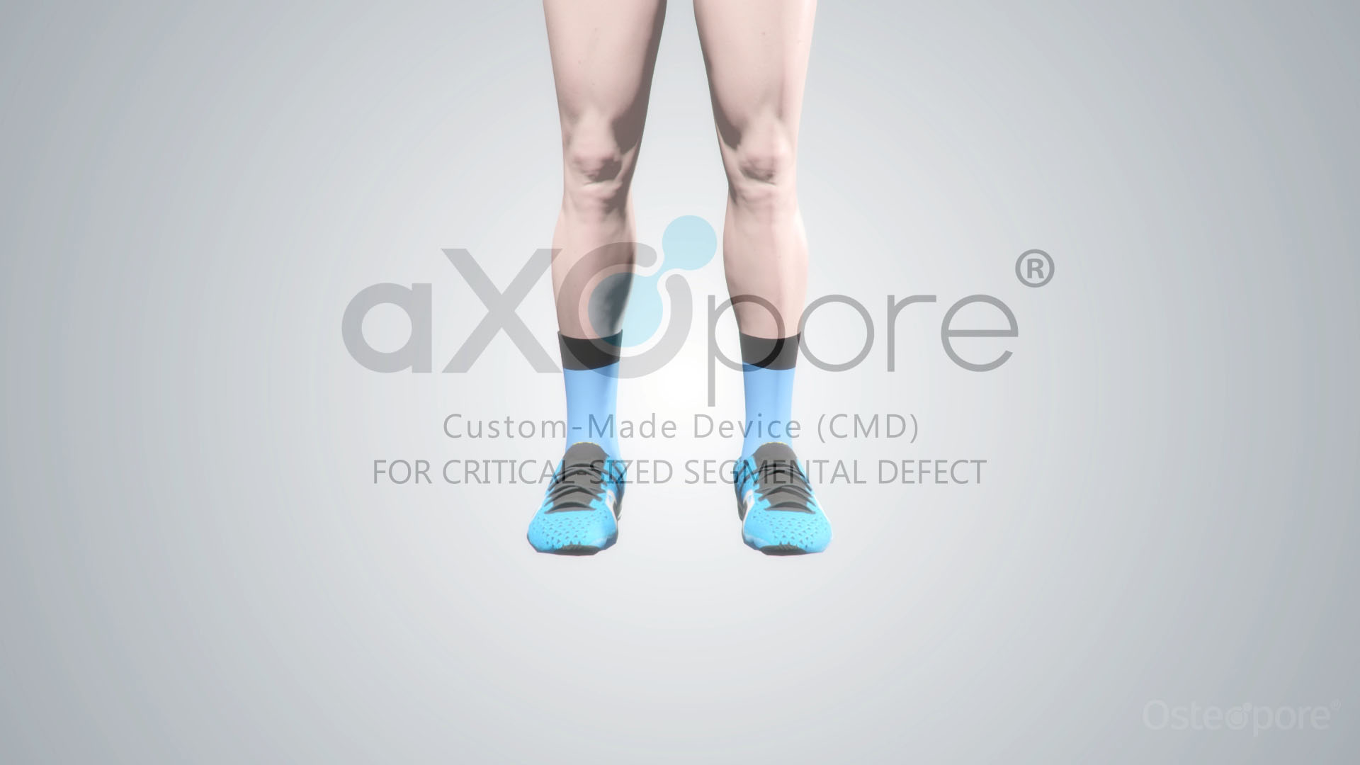 aXOpore feature video